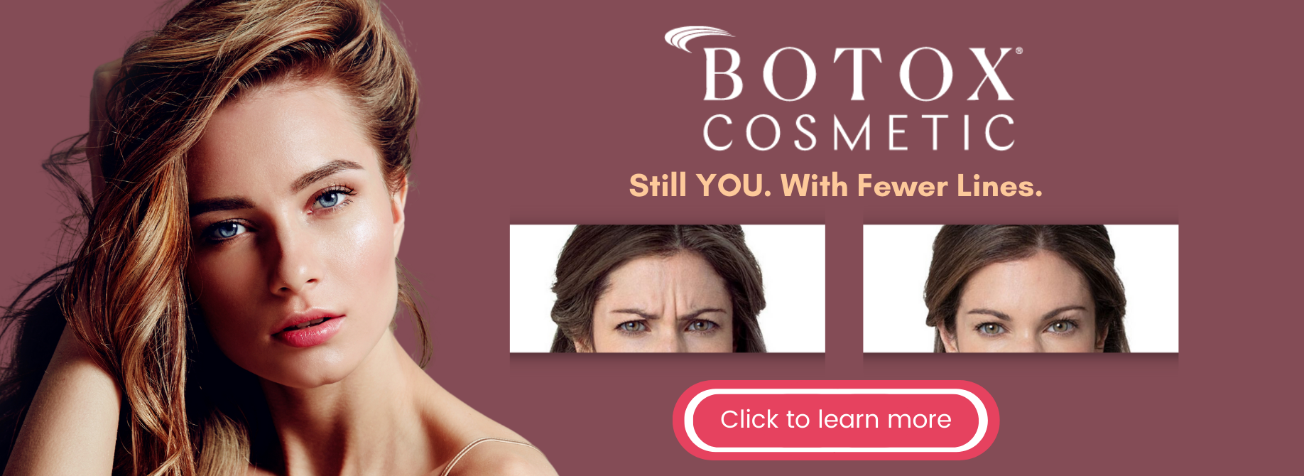 Faces of South Tampa Botox Cosmetic